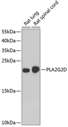 Anti-PLA2G2D antibody used in Western Blot (WB). GTX65810