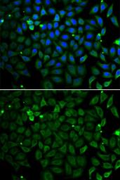 Anti-Parkin antibody used in Immunocytochemistry/ Immunofluorescence (ICC/IF). GTX65812