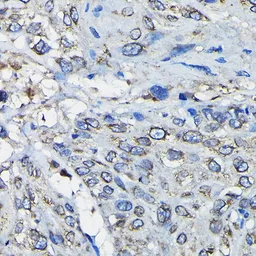 Anti-RanGAP1 antibody used in IHC (Paraffin sections) (IHC-P). GTX65813