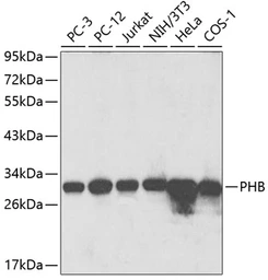 Anti-Prohibitin antibody used in Western Blot (WB). GTX65815