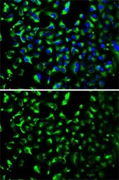Anti-Prohibitin antibody used in Immunocytochemistry/ Immunofluorescence (ICC/IF). GTX65815