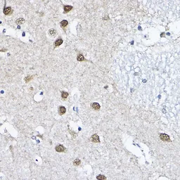 Anti-ORC6 antibody used in IHC (Paraffin sections) (IHC-P). GTX65816