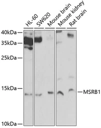 Anti-Selenoprotein R antibody used in Western Blot (WB). GTX65818