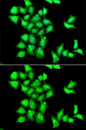 Anti-Selenoprotein R antibody used in Immunocytochemistry/ Immunofluorescence (ICC/IF). GTX65818