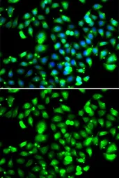 Anti-GBP1 antibody used in Immunocytochemistry/ Immunofluorescence (ICC/IF). GTX65821