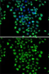 Anti-METTL11A antibody used in Immunocytochemistry/ Immunofluorescence (ICC/IF). GTX65824
