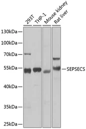 Anti-SLA/LP antibody used in Western Blot (WB). GTX65825