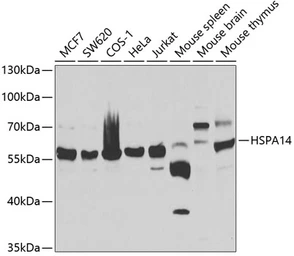Anti-Hsp 60 antibody used in Western Blot (WB). GTX65826
