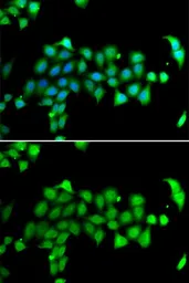 Anti-Hsp 60 antibody used in Immunocytochemistry/ Immunofluorescence (ICC/IF). GTX65826