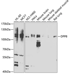 Anti-DPRP1 antibody used in Western Blot (WB). GTX65827