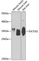Anti-Estrogen Sulfotransferase antibody used in Western Blot (WB). GTX65828