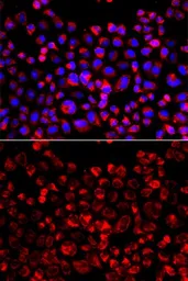 Anti-Estrogen Sulfotransferase antibody used in Immunocytochemistry/ Immunofluorescence (ICC/IF). GTX65828