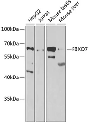 Anti-FBXO7 antibody used in Western Blot (WB). GTX65829