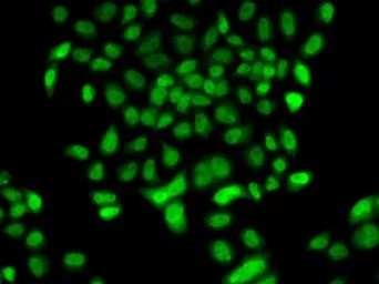 Anti-FBXO7 antibody used in Immunocytochemistry/ Immunofluorescence (ICC/IF). GTX65829