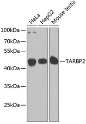 Anti-TRBP2 antibody used in Western Blot (WB). GTX65830