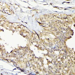 Anti-TRBP2 antibody used in IHC (Paraffin sections) (IHC-P). GTX65830