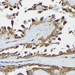 Anti-TRBP2 antibody used in IHC (Paraffin sections) (IHC-P). GTX65830