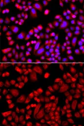 Anti-p21-ARC antibody used in Immunocytochemistry/ Immunofluorescence (ICC/IF). GTX65831