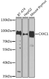 Anti-CGBP antibody used in Western Blot (WB). GTX65832