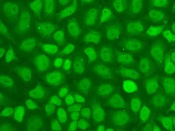 Anti-CGBP antibody used in Immunocytochemistry/ Immunofluorescence (ICC/IF). GTX65832