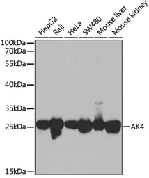 Anti-Adenylate kinase 4 antibody used in Western Blot (WB). GTX65835