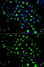 Anti-Adenylate kinase 4 antibody used in Immunocytochemistry/ Immunofluorescence (ICC/IF). GTX65835