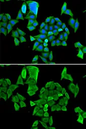 Anti-CCAR1 antibody used in Immunocytochemistry/ Immunofluorescence (ICC/IF). GTX65837