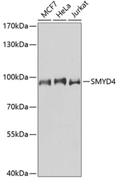 Anti-SMYD4 antibody used in Western Blot (WB). GTX65838