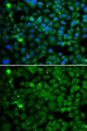 Anti-SMYD4 antibody used in Immunocytochemistry/ Immunofluorescence (ICC/IF). GTX65838