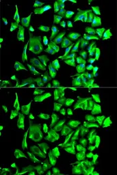 Anti-Hsp90 beta antibody used in Immunocytochemistry/ Immunofluorescence (ICC/IF). GTX65840