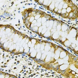 Anti-Hsp90 beta antibody used in IHC (Paraffin sections) (IHC-P). GTX65840