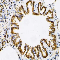 Anti-Hsp90 beta antibody used in IHC (Paraffin sections) (IHC-P). GTX65840