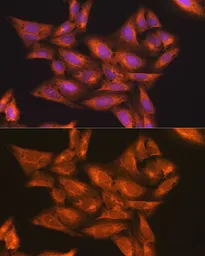Anti-IKK gamma antibody used in Immunocytochemistry/ Immunofluorescence (ICC/IF). GTX65841