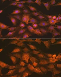 Anti-IKK gamma antibody used in Immunocytochemistry/ Immunofluorescence (ICC/IF). GTX65841