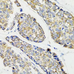 Anti-IKK gamma antibody used in IHC (Paraffin sections) (IHC-P). GTX65841