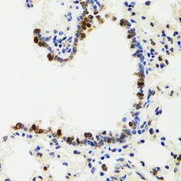 Anti-IKK gamma antibody used in IHC (Paraffin sections) (IHC-P). GTX65841