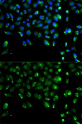 Anti-ATG13 antibody used in Immunocytochemistry/ Immunofluorescence (ICC/IF). GTX65842