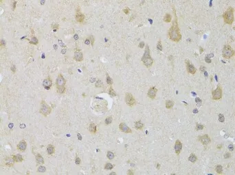 Anti-ATG13 antibody used in IHC (Paraffin sections) (IHC-P). GTX65842