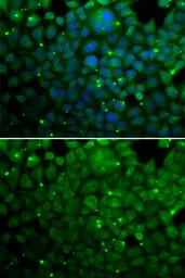 Anti-alpha A Crystallin antibody used in Immunocytochemistry/ Immunofluorescence (ICC/IF). GTX65843