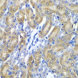 Anti-alpha A Crystallin antibody used in IHC (Paraffin sections) (IHC-P). GTX65843