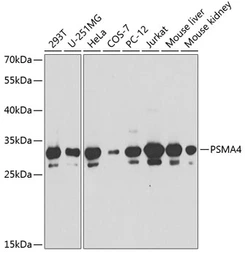 Anti-PSMA4 antibody used in Western Blot (WB). GTX65846
