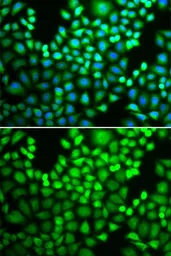 Anti-PSMA4 antibody used in Immunocytochemistry/ Immunofluorescence (ICC/IF). GTX65846
