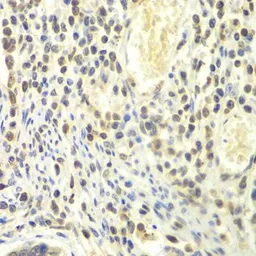 Anti-PSMA4 antibody used in IHC (Paraffin sections) (IHC-P). GTX65846