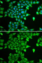 Anti-PSMA6 antibody used in Immunocytochemistry/ Immunofluorescence (ICC/IF). GTX65847