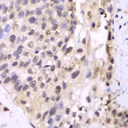 Anti-PSMA6 antibody used in IHC (Paraffin sections) (IHC-P). GTX65847