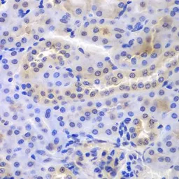 Anti-PSMA6 antibody used in IHC (Paraffin sections) (IHC-P). GTX65847