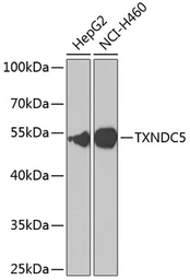 Anti-TXNDC5 antibody used in Western Blot (WB). GTX65848