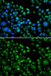 Anti-TXNDC5 antibody used in Immunocytochemistry/ Immunofluorescence (ICC/IF). GTX65848