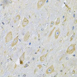 Anti-TXNDC5 antibody used in IHC (Paraffin sections) (IHC-P). GTX65848