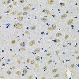 Anti-TXNDC5 antibody used in IHC (Paraffin sections) (IHC-P). GTX65848